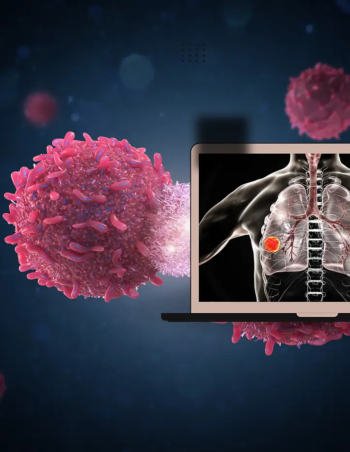 Non Small Cell Lung Cancer (nsclc) Non Small Cell Lung Cancer (nsclc)